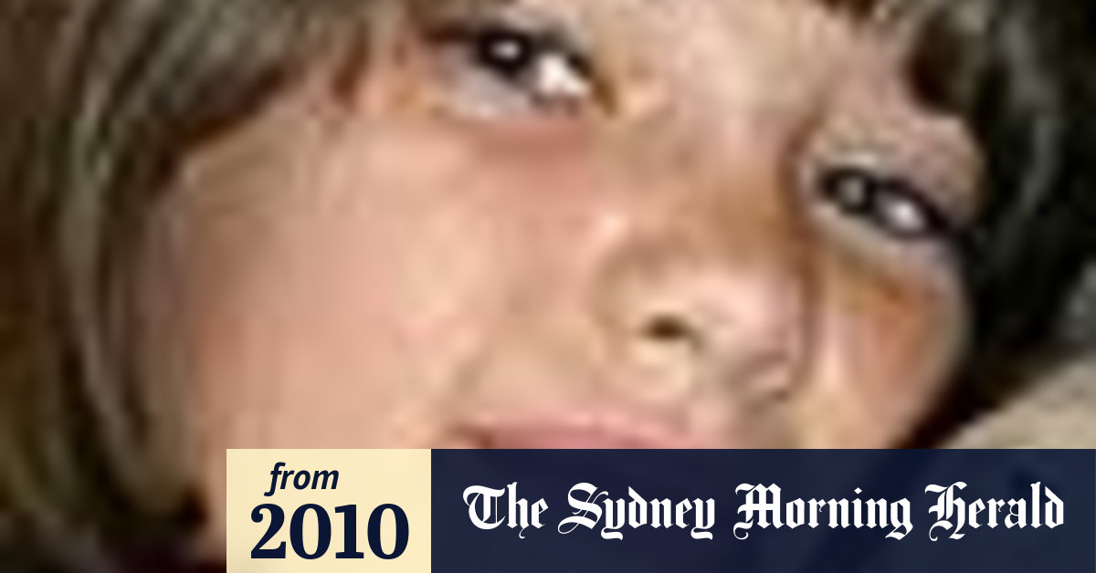 Girl survives deadly box jellyfish stings doctors amazed